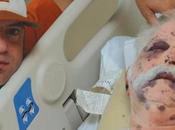 Foto giorno settembre 2010 vivo dopo essere stato punto 1200 volte