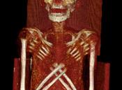 prove cancro sulla mummia giovane Egizio