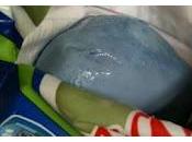 Ritornano mozzarelle