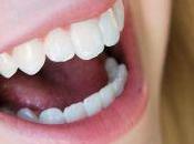 Come fare mantenere Denti bianchissimi?