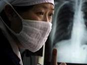 Pechino:grave epidemia tubercolosi