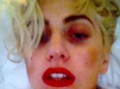 Lady Gaga: Dopo colpo, particolarmente forte concerto