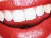 Denti bianchi