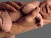 L'Osteopatia pediatrica