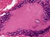 Cos'è Tuberculinum?