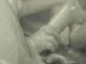 Neonata stringe dito medico alla nascita Foto diventa virale internet