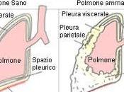 Amianto: alla Grandi Motori morti indagati 1971 2000