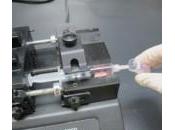 dispositivo microfluidi screening cancro alla prostata