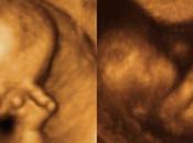 Arkansas vietato uccidere dopo settimane