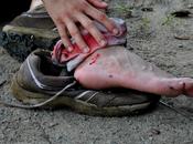 mobilità Italia, stagno sanguisughe