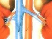 Reni: antibiotici fluorochinolonici aumenta rischio malattia