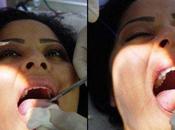 Follia toppa cucita sulla lingua dimagrire fortuna costa poco...