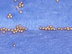 Impianto grani d’oro (Gold Beads Implants)