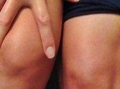 Artrosi dolore ginocchio: l'efficacia dell'agopuntura