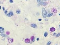 microalga killer: Prototheca cutis