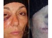 Usa, poliziotto pesta sangue donna: volto sfigurato (Video)