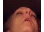 Usa, donna overdose resuscitata dopo iniezione nuovo farmaco (Video)