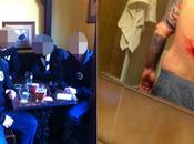 schifo tifosi quelli Juventini- accoltellato tifoso danese, pacifici mondo