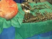 Estirpano tumore alle ovaie donna, Spagna. Solo cinque casi simili mondo