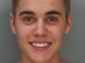 Justin Bieber prigione:l'udienza cauzione