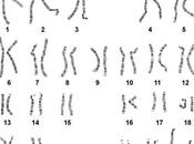 Disomia cromosoma disgiunzione paterna meiosi