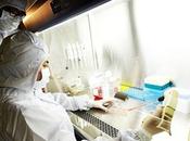 Cellule staminali cordone ombelicale: successo terapia contro Parkinson