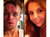 lascia dopo mesi, taglia gola: “Brutta figura amici”