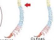 Portare verticalmente: colonna vertebrale assume posizione corretta?