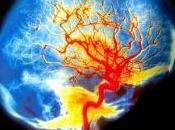 Sclerosi Multipla: scoperte REALI nella ricerca