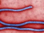 Allarme Ebola volo Bruxelles falso allarme