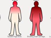 Ebola, notizie buone cattive
