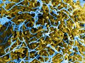 Ebola, l'intelligenza artificiale aiuta trovare cura