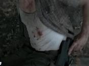 Walking Dead S05E05 [recensione]