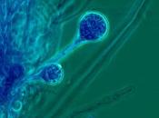 Come diagnosticare tigna
