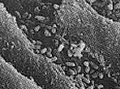 Denti devitalizzati malattie degenerative
