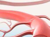 Primo vaso sanguigno artificiale, salvato bimbo anni