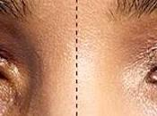 Contro occhiaie rimedi naturali