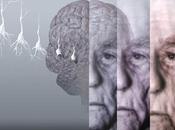 Alzheimer, vivere paesi freddi aumenta rischio ammalarsi