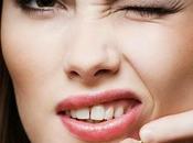 Prevenire eliminare punti neri