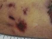 Caso Magherini, rinviati giudizio carabinieri hanno arrestato. Polemiche aula