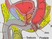 Come prevenire problemi alla prostata l’alimentazione [Infografica].