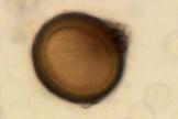 Latrine vecchi parassiti