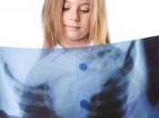 Bambini: troppi esami radiologici inutili