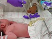 Cordone ombelicale: momento giusto “chiuderlo”