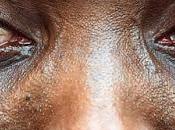 Bonomi: profughi sono nuovi rom, capri espiatori della nostra società»