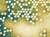 Bambini paralizzati Ucraina seguito poliomielite