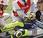 Pauroso incidente Valentino Rossi: rottura tibia perone