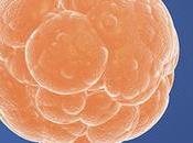 Cellule staminali embrionali: 2018, trial clinici sull’uomo contro Parkinson