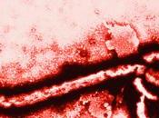 dichiara Guinea ebola-free.