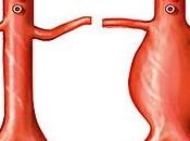 diagnosticare l’aneurisma dissecante dell’aorta facendo pronunciare lettera paziente